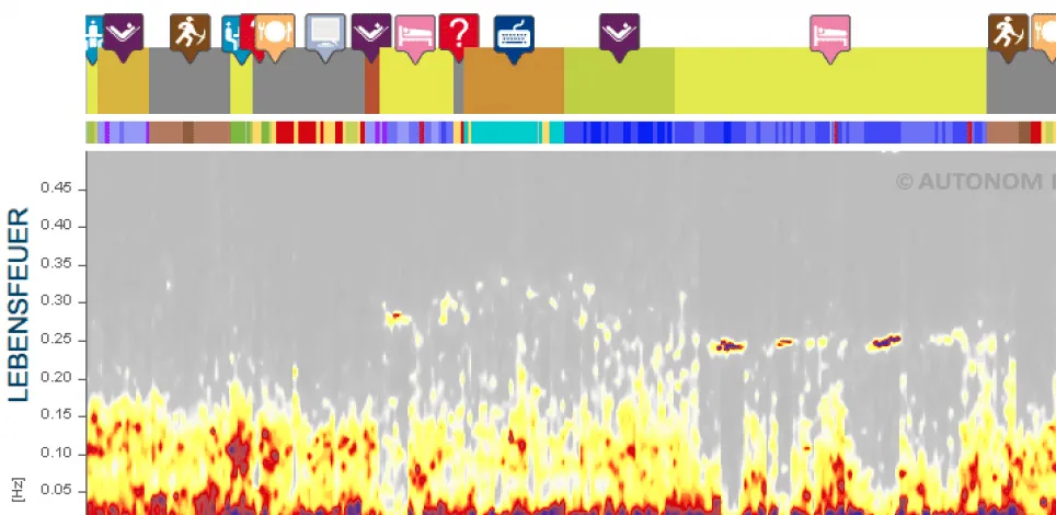 HRV-Med-Lebensfeuer-Messung HRV-Med-Lebensfeuer-Messung